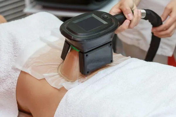 Image of person having fat freezing treatment to help weight gain Faringdon