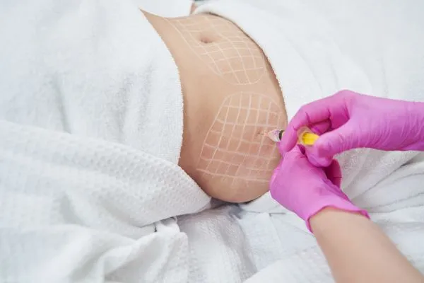image of fat dissolving injections on love handles to help combat weight gain Faringdon