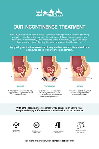 image to show how EMS treatment works for female urinary incontinence Faringdon