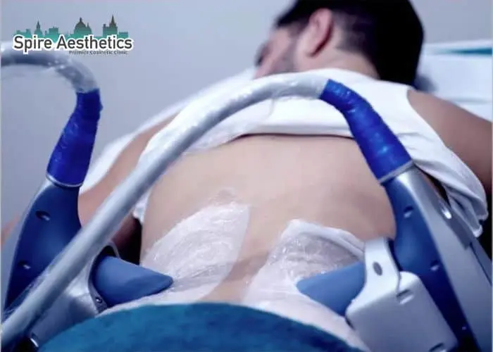 Man having fat freezing treatment done on love handles before a competitions Faringdon to create a sculpted look.