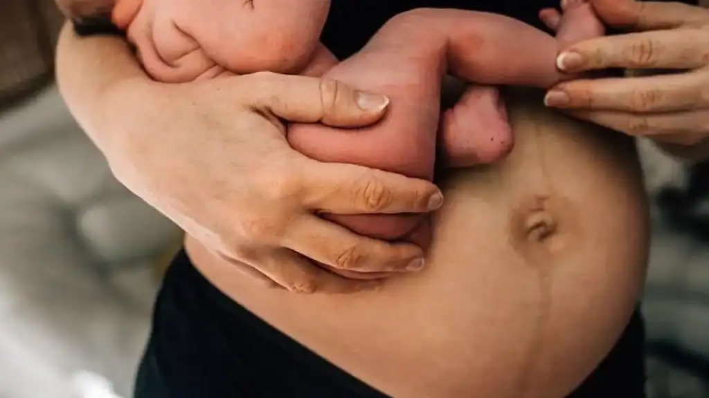 Why Is My Stomach Still Big After Pregnancy Faringdon?