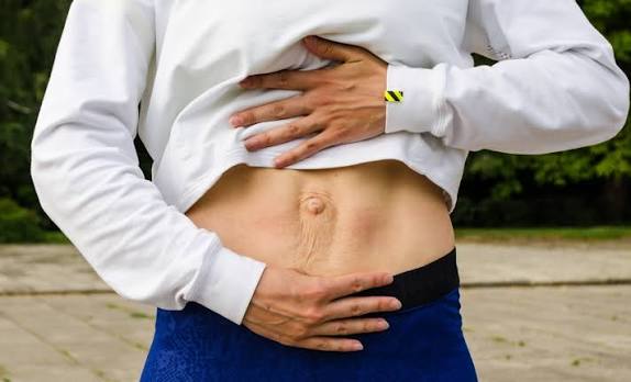 When Could Diastasis Recti Be the Missing Piece of the Puzzle Faringdon?